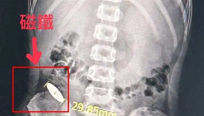 台南小一生遭學長霸凌「逼吞3公分磁鐵」　補習班竟無畫面