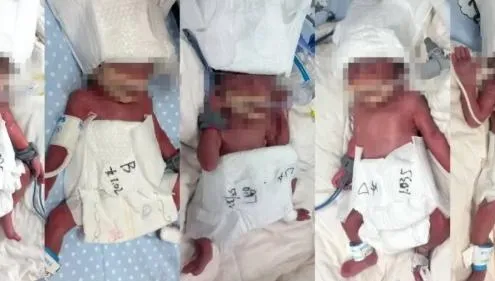 影/6000萬分之一的奇蹟！新疆24歲女順利產下「1男4女」五胞胎