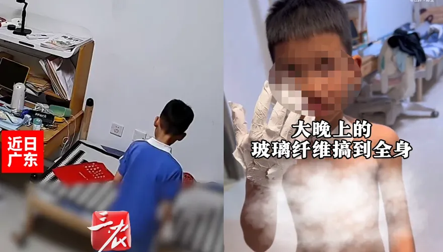 家長注意！陸男童好奇玩「滅火毯」　全身被扎滿超細玻璃纖維