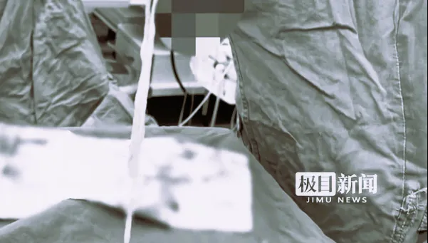 陸老婦乳房有硬塊…手術取出30cm活蟲　醫：游走炸彈恐致死