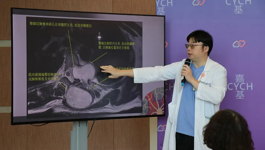 飽受背痛折磨12年！41歲女跨三科精準「拆彈」成功