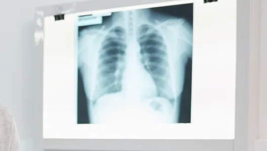 中年男「指甲異狀」一查竟是肺癌！　醫曝危險症狀