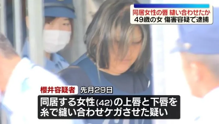 日茨城驚傳恐怖虐待案！女子嘴唇遭縫合　逃至商店持紙條求救