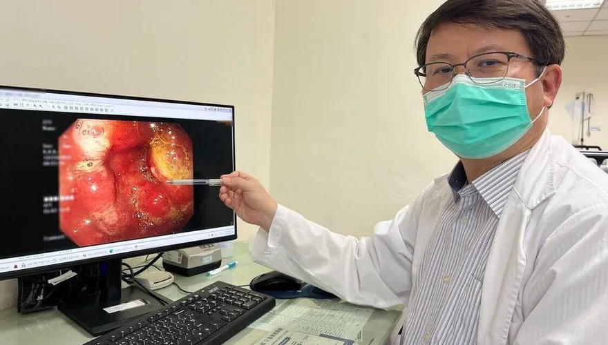 台中男胃脹氣半年就醫竟罹胃癌！醫提醒：共食習慣恐導致幽門桿菌