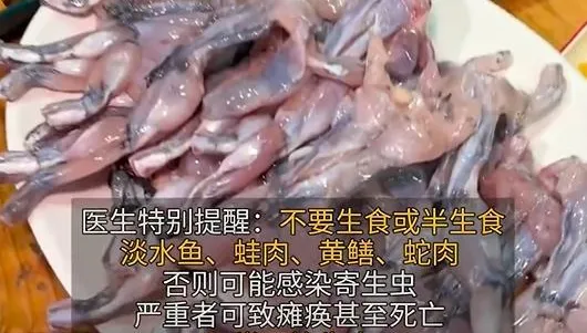 驚悚！陸男頭痛、腿麻12年　竟因嗜吃牛蛙「寄生蟲爬滿脊隨」