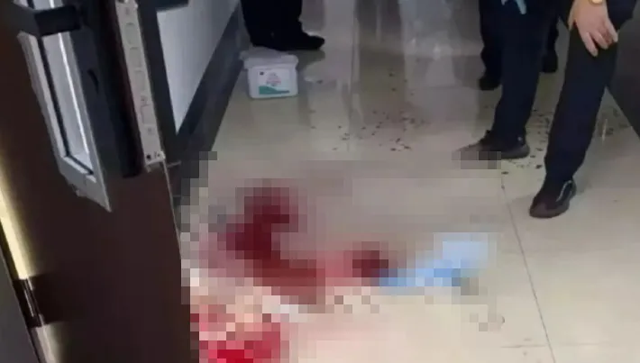陸名校實驗室驚傳爆炸！碩士生「三指炸飛」滿地血　驚悚畫面曝光
