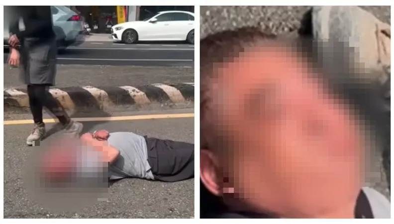 行車糾紛老翁倒地「一張圖看出嚴重度」　醫：雙手姿勢是關鍵