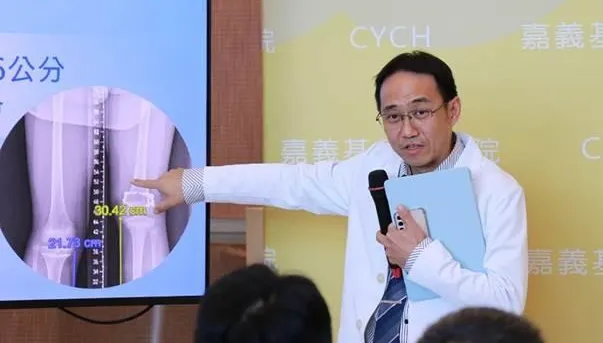 走路總是一拐一拐！15歲少年長短腿差16公分成功矯正