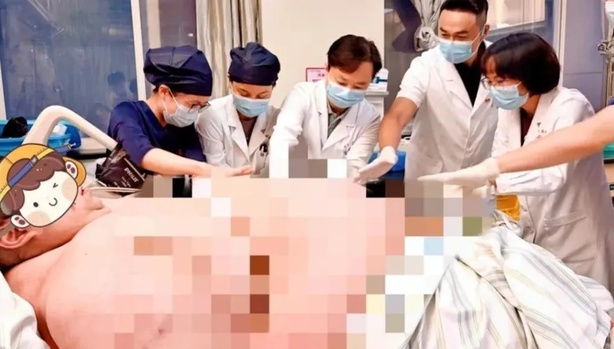 317公斤胖到「躺不下」！30歲陸男多器官衰竭　搶救13天保命