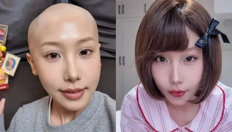 甜美網紅「胃癌過世」得年25歲！曾反省患病前「常熬夜常喝奶茶」