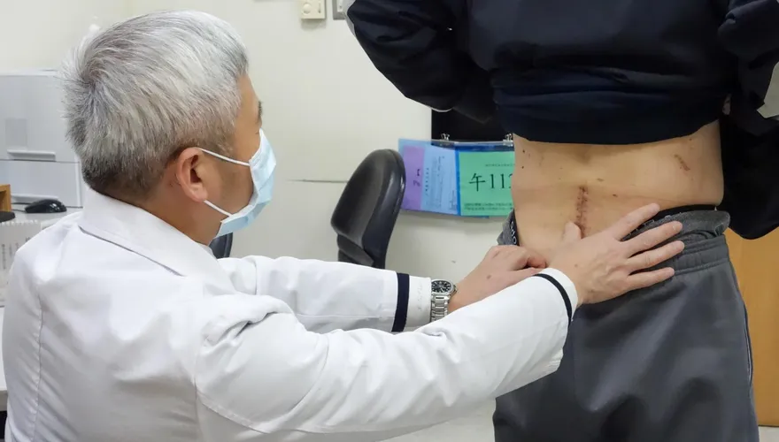 腳踩地像針扎、站都站不穩！六旬翁腰椎術後痛2年揪出囊腫