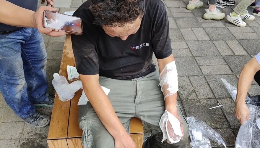 屏東高爾夫球具廠大爆炸／雞尾酒式多模止痛療法　傷燙傷患可有效止痛