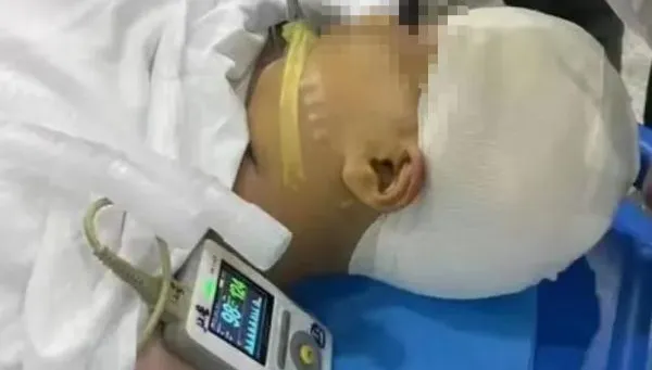 9歲女童遭男師打破頭骨「腦漿流出」　甦醒駁誤傷說法：故意打了2次