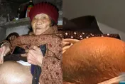 91歲阿嬤跌倒「離奇懷孕」！醫見完整胎兒震驚　一跤竟摔出60年秘密
