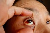 婦人眼睛紅腫、搔癢就醫　驚見「上百隻寄生蟲」布滿睫毛！