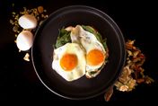 不吃蛋就不會攝取過多膽固醇？營養師：小心「這些食物」都算蛋！