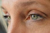 乾眼症文明病出現年輕化！ 眼科醫分析成因與治療趨勢