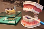 國人8成都有「這病」！57歲婦牙齒鬆動又出血　原來是罹患嚴重「牙周病」！