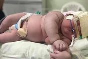 巴西誕生「7.3公斤」超級巨嬰　一出生就直上「9個月大嬰兒衣服」打破當地紀錄！