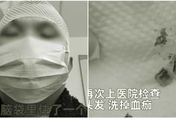 影/打完籃球6天後「頭頂散發腐臭味」　就診一查懵了：「長」了2顆牙