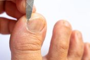 指甲剪別共用！醫警告恐細菌感染：4類人小心「甲溝炎」反覆發作