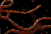 14人確診死亡！非洲二國爆發致命馬堡病毒疫情　美CDC已派員前往了解