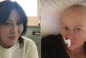 飛越比佛利！資深女星乳癌4期癌末！頭髮全掉光　醫曝3類人「致癌高4倍」