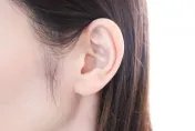 耳大又外擴「招風耳」該不該整形？整外名醫：5-7歲就能作矯正手術