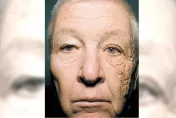 太陽很毒！69歲卡車司機「只有左臉曬太陽」臉竟只有半邊快速老化