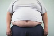 117公斤男少吃多動瘦不了　「內視鏡胃袖整形術」1個月減去12公斤