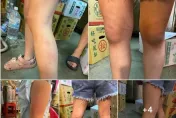 7歲女童「九九乘法」沒背好！被安親班爆打「四肢都是傷」　教育局介入調查