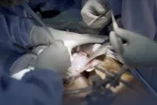 美「異種器官移植」破紀錄　豬腎臟在腦死人體內正常運作2個月