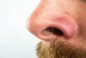 「鬼剃頭」恐影響鼻毛數量！研究證實：鼻毛越少越容易過敏