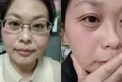 42歲女「斷崖式衰老」！20天臉上佈滿皺紋　8生活習慣是老化加速器