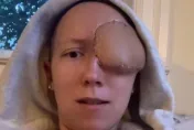美28歲女右眼痛被誤診鼻竇炎！二度就診驚見「高爾夫球大」腫塊　右眼慘被摘除