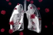 不菸、不酒！36歲男「肺癌腦轉移」壽命剩3個月　戲劇性靠一技術活下來了！