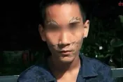 遭朋友慫恿花500元「全臉刺青」！16歲泰國男後悔：找不到工作跟女友