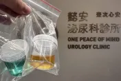 越南台商尿道炎「尿尿顏色變tiffany綠」！醫揭密和藥物有關