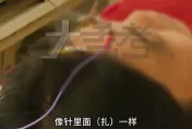 陸大媽路邊攤點痣釀「眼角膜燒傷」險失明　痛喊：恨不得把眼睛挖出來