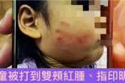 阿嬤跟妳拚了！桃園幼幼班女童午休發出聲響　教保員竟狂搧巴掌「留紅指印」