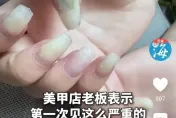 愛美女生注意！雲南女子卸美甲　指甲竟發霉變綠