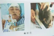 被「嚇死」！甘肅女目睹母親車禍後胸悶心悸　5天後竟猝死