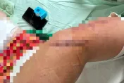 台南仁德服務區驚見隨機砍人！　肌腱斷裂全身中多刀