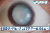 一夜之間「瞳孔全白」！愛喝飲料嗑鍋…25歲陸男患「白內障」