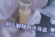 天天吃火鍋「連吃4個月」！陸女抽出「奶油血」數值超標45倍