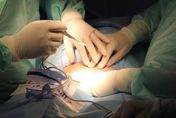 19歲少女「嫌腿粗」瞞父母抽脂　「主刀醫沒執照」術後3天器官衰竭亡