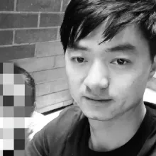 小楊哥罹「膠質母細胞瘤」病逝！　醫嘆：平均存活期僅半年