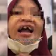 逼印尼女移工吃屎又打斷牙！天母惡夫妻沒被判刑　驚人原因曝