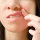 嘴破超過2週恐罹癌！醫揭「破、斑、硬」都是前兆