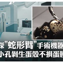 陸機器人太狂了!術銳研製「蛇形臂」單孔手術機器人 小孔剝生蛋殼"不損蛋膜"~還可在8000km外動手術｜大陸360°